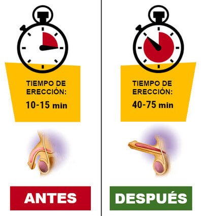 before-after-new2-es.jpg before-after-new2-es.jpg
