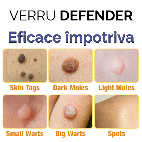 Copia-di-VERRU-DEFENDER-3.png Copia-di-VERRU-DEFENDER-3.png
