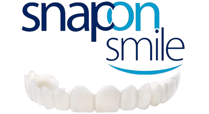 snap-on-smile-prod-1-1.png